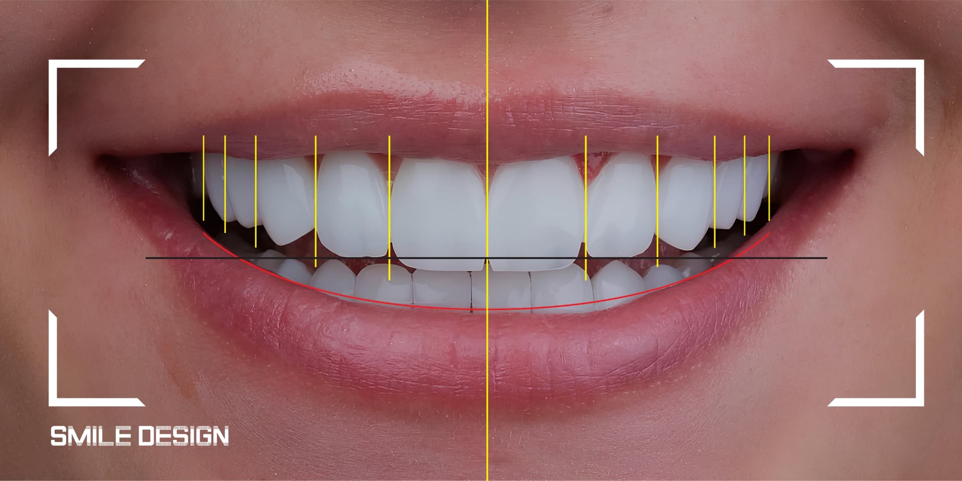 Cosmetic Dentistry at 3D Dental
