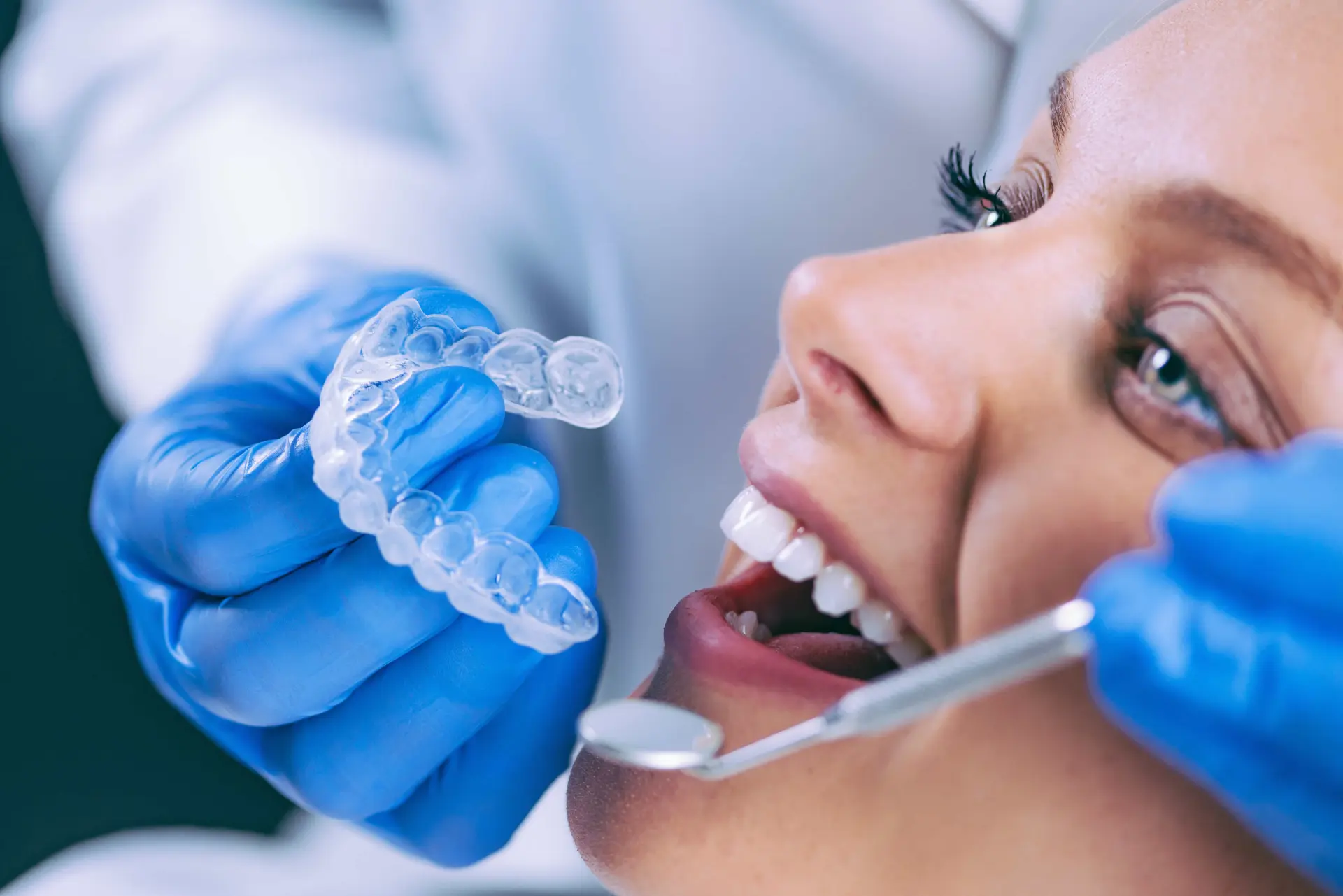 Teeth Whitening at 3D Dental