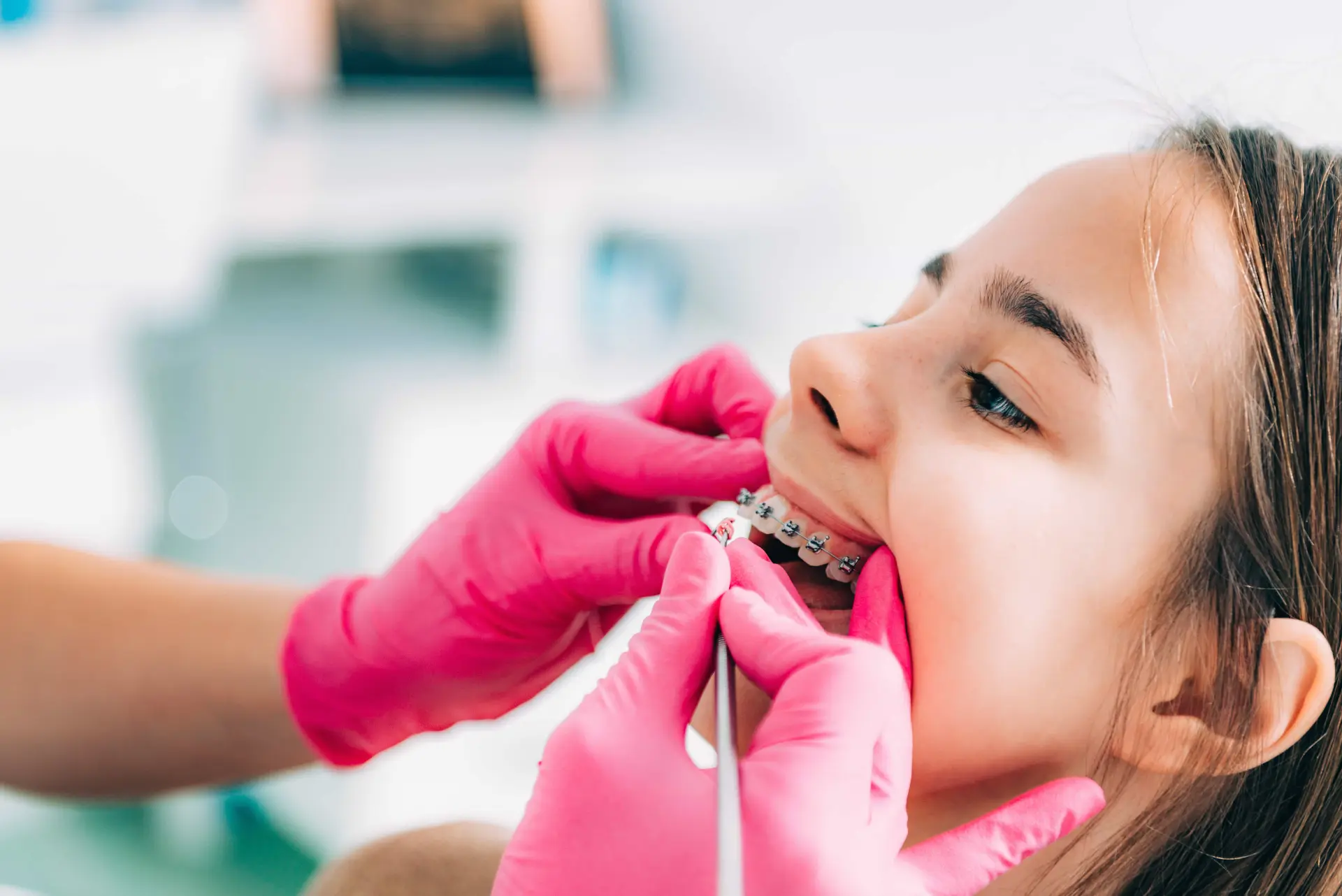 Dental Braces at 3D Dental